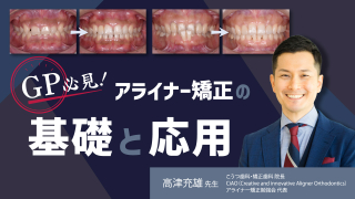 GP必見！アライナー矯正の基礎と応用の画像です。