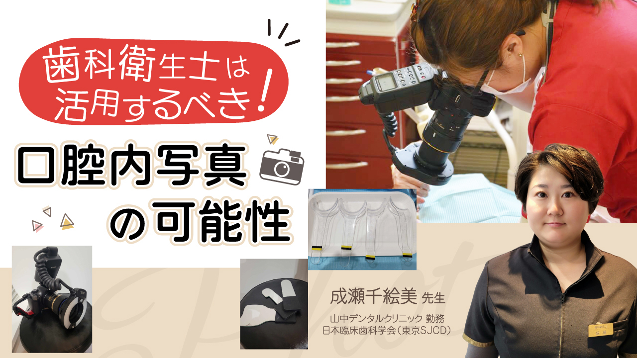 歯科衛生士は活用するべき！〜口腔内写真の可能性〜の画像です。