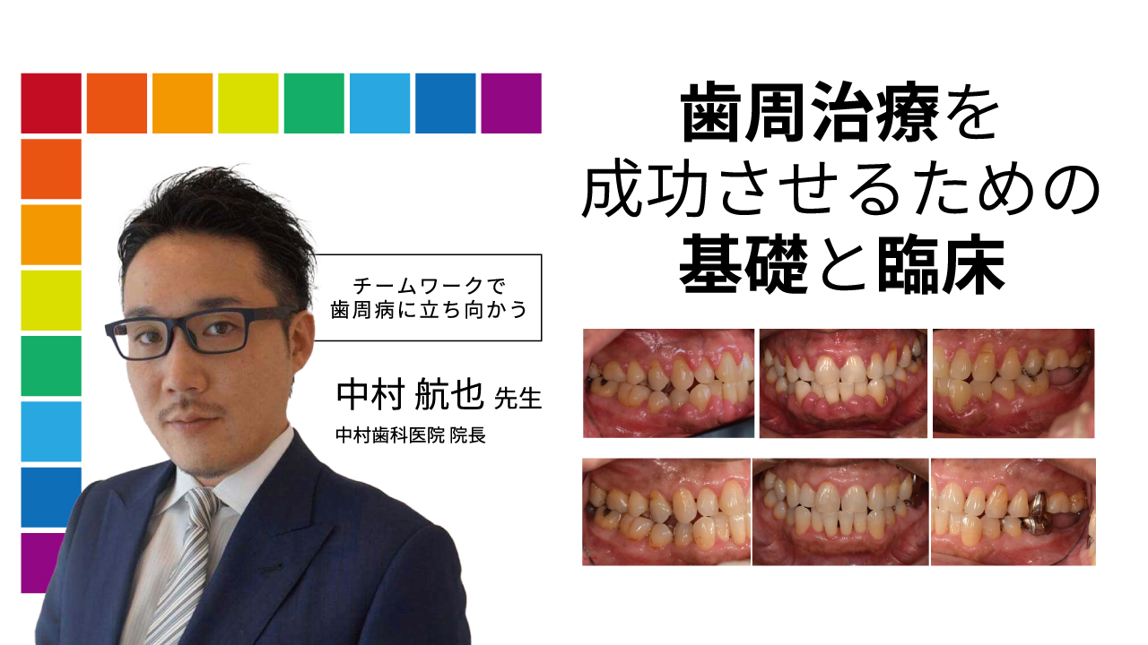 歯周治療を成功させるための基礎と臨床～チームワークで歯周病に立ち向かう～の画像です。