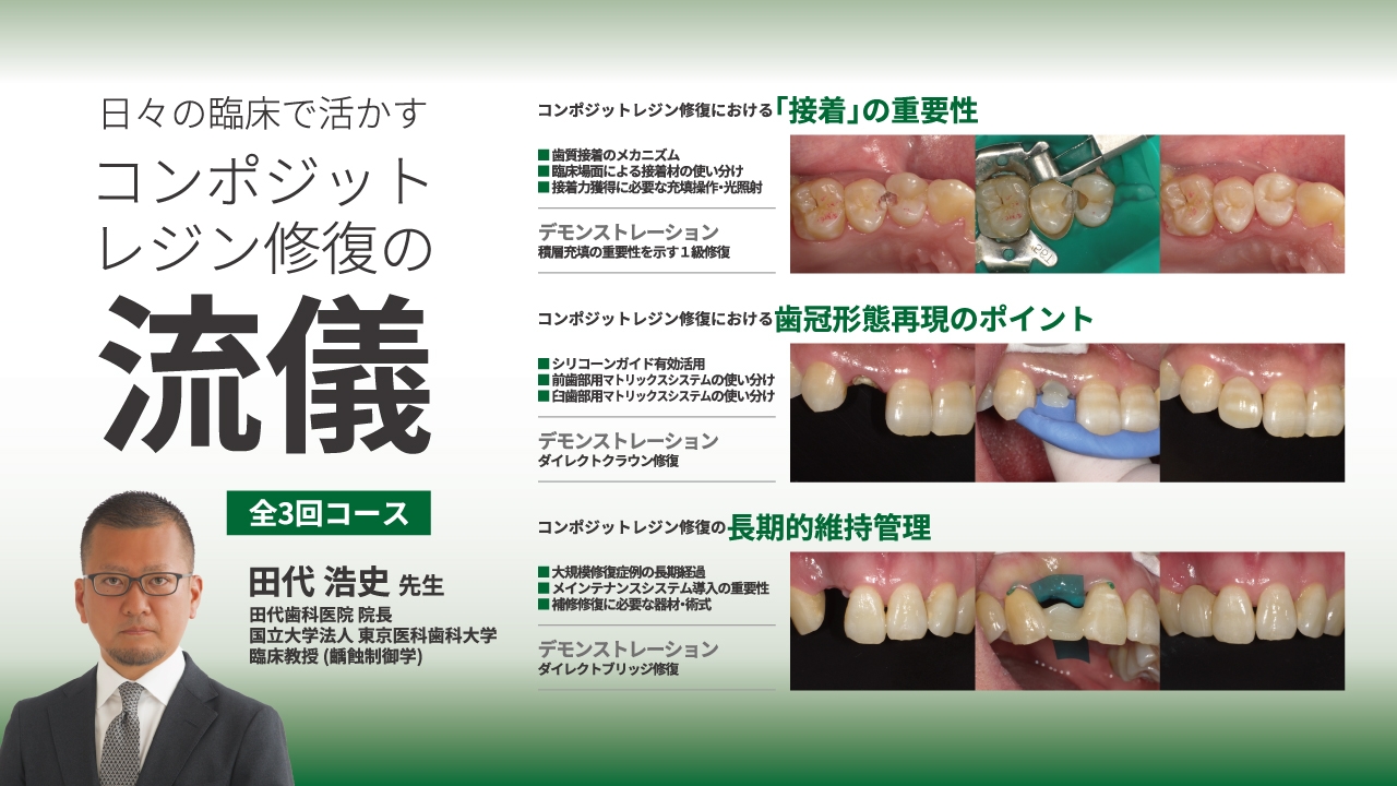 日々の臨床で活かす～コンポジットレジン修復の流儀～（全3回