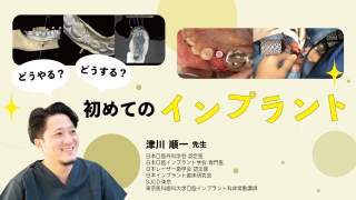 どうやる？どうする？初めてのインプラントの画像です。