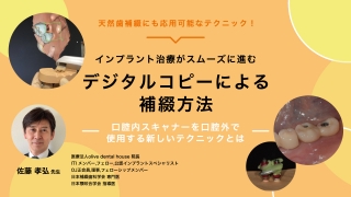 インプラント治療がスムーズに進むデジタルコピーによる補綴方法 ―口腔内スキャナーを口腔外で使用する新しいテクニックとは―の画像です。