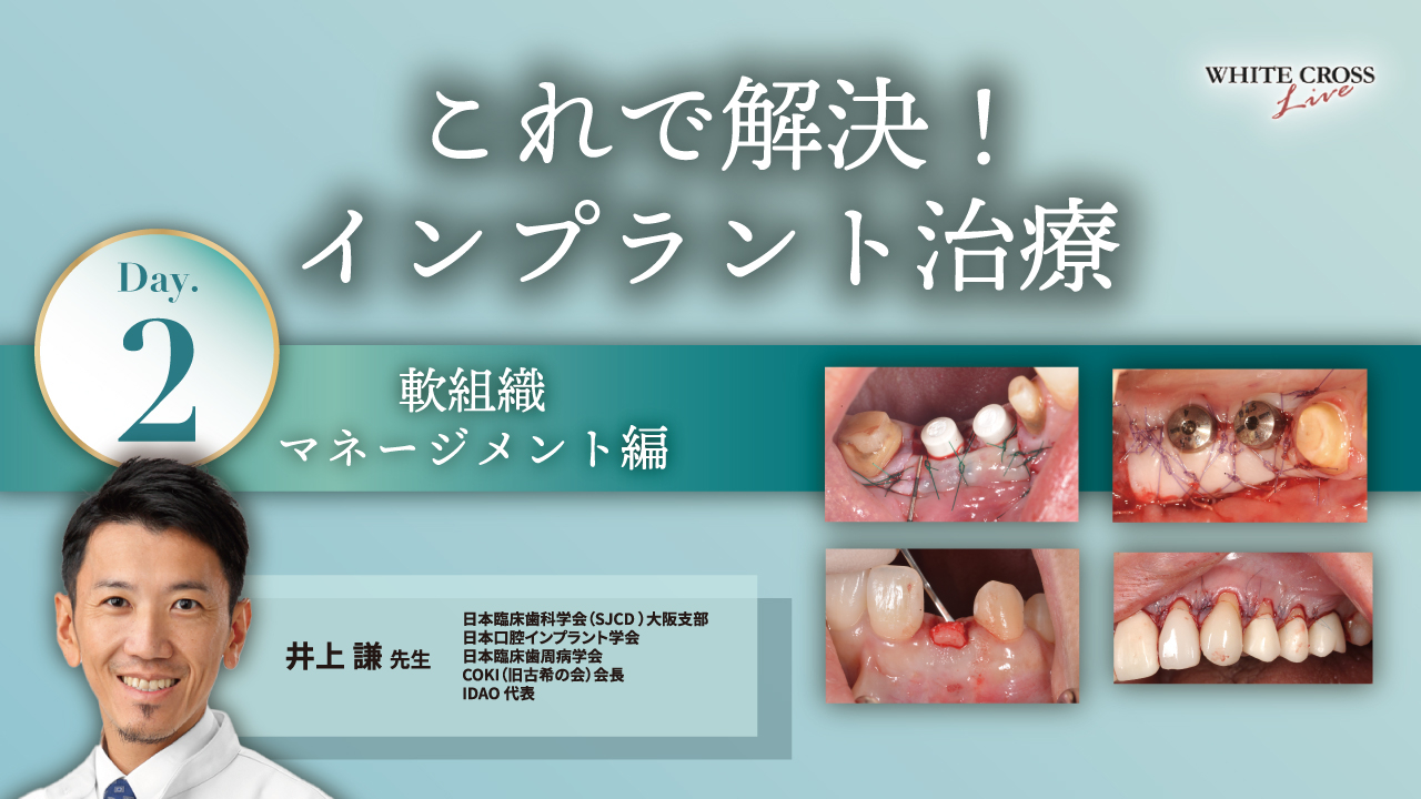 これで解決！インプラント治療 Day2「軟組織マネージメント」編