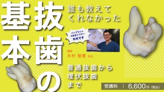 誰も教えてくれなかった、抜歯の基本 〜普通抜歯から埋伏抜歯まで〜の画像です。