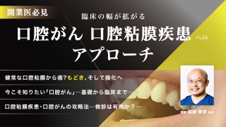 開業医必見　臨床の幅が拡がる口腔粘膜疾患・口腔がんへのアプローチの画像です。