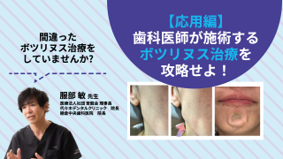 【応用編】歯科医師が施術するボツリヌス治療を攻略せよ！の画像です。