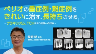 成長・発達期における不正咬合の早期治療 成長・発達期における不正咬合の早期治療 | 佐藤貞雄, 白数明義