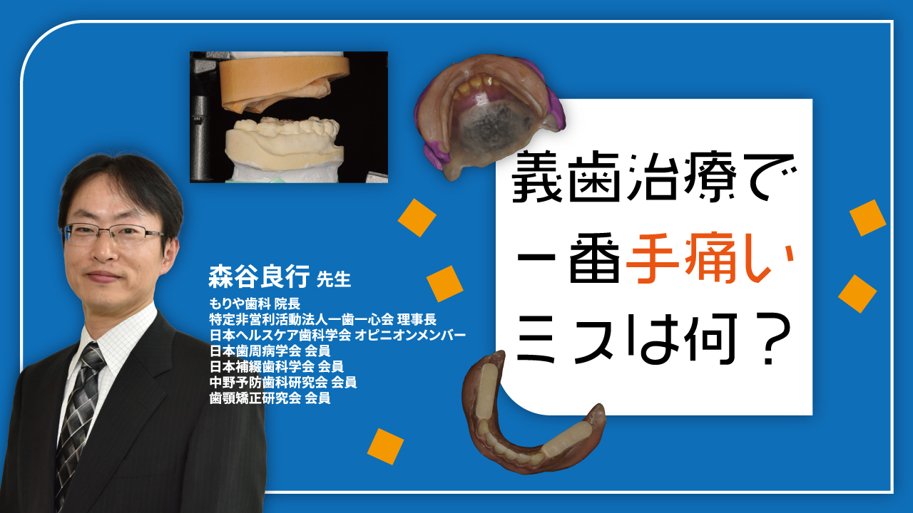 義歯治療で一番手痛いミスは何？ | WHITE CROSS