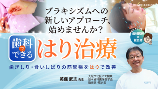 歯科でできるはり治療〜歯ぎしり・食いしばりの筋緊張をはりで改善〜の画像です。