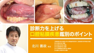 診断力を上げる、口腔粘膜疾患鑑別のポイントの画像です。
