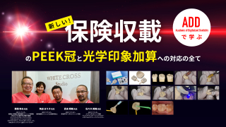 新しい！保険収載のPEEK冠と光学印象加算への対応の全ての画像です。