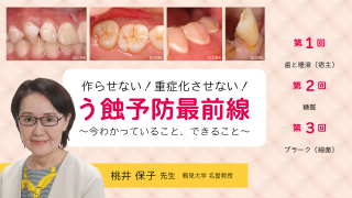 作らせない！重症化させない！う蝕予防最前線〜今わかっていること、できること〜の画像です。
