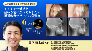 外れることなく超精密かつ最速のアタッチメント設置が実現！年間600