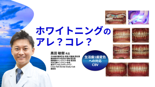 ホワイトニングのアレ？コレ？生活歯1歯変色へのホワイトニング（CBV）の画像です。