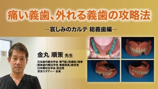スタッフと共有したい、成功する義歯の概形印象テクニック 2回