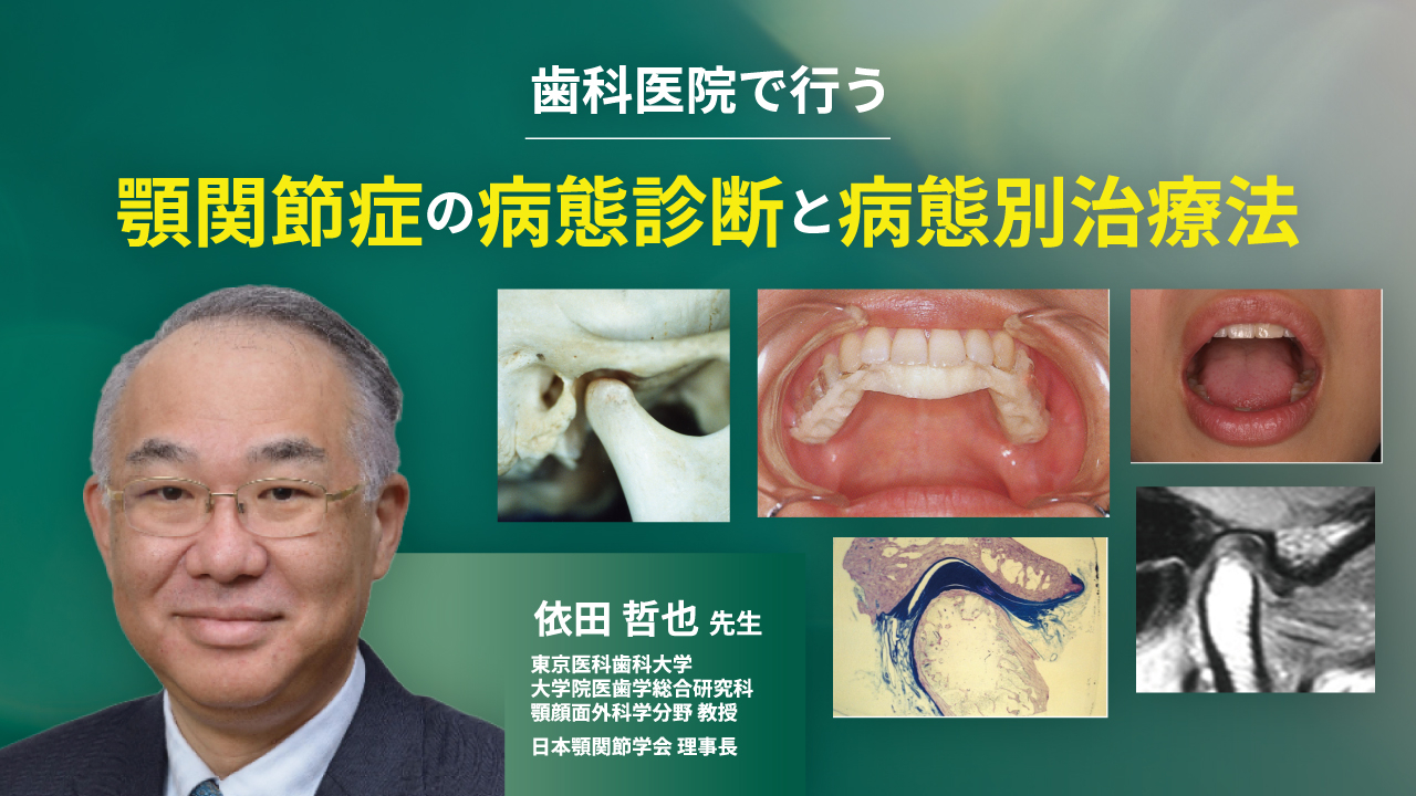 歯科医院で行う顎関節症の病態診断と病態別治療法の画像です。