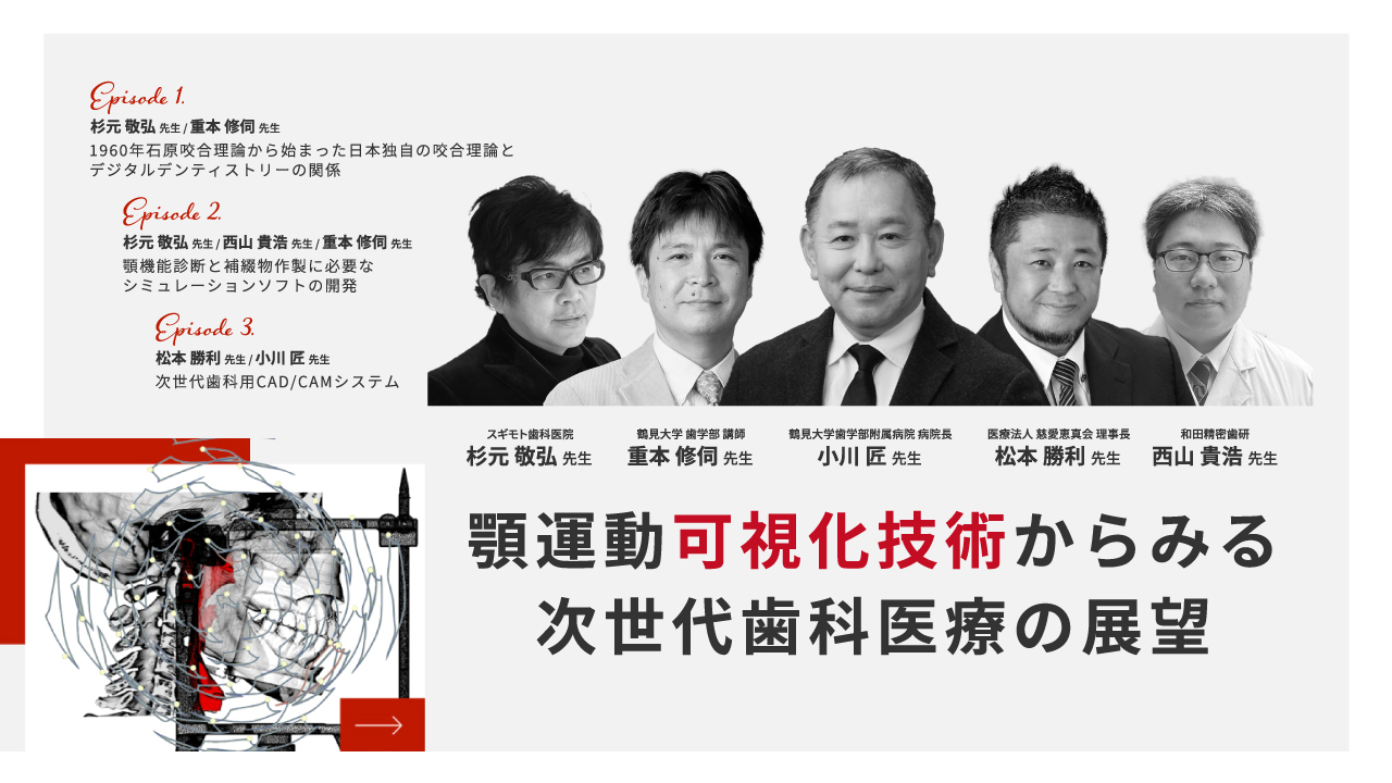 顎運動可視化技術からみる次世代歯科医療の展望 | WHITE CROSS
