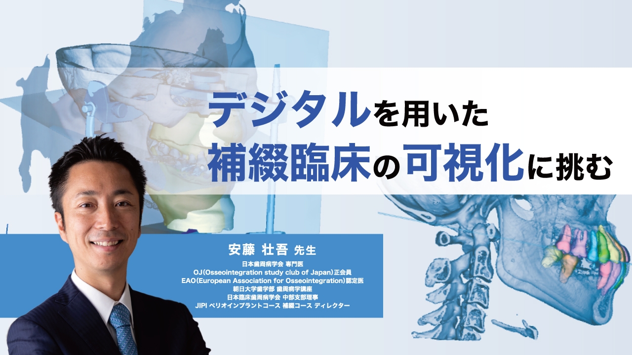 デジタルを用いた補綴臨床の可視化に挑む | WHITE CROSS