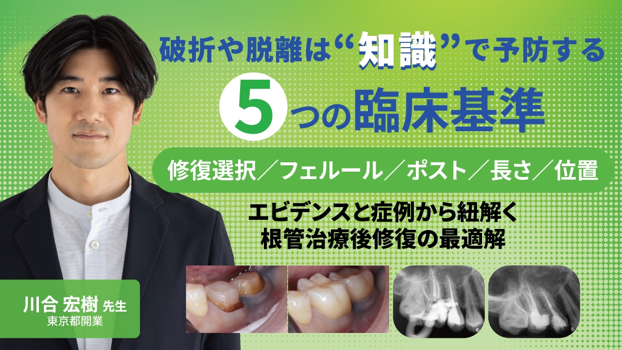 エビデンスと症例から紐解く根管治療後修復の最適解 | WHITE CROSS