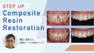 STEP UP　Composite Resin　Restorationの画像です。