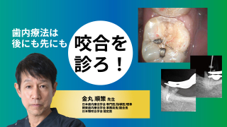 歯内療法は後にも先にも咬合を診ろ！の画像です。