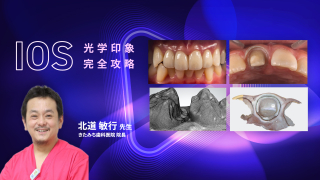 IOS光学印象完全攻略の画像です。