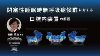 閉塞性睡眠時無呼吸症候群に対する口腔内装置の解説の画像です。