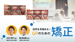 外れることなく超精密かつ最速のアタッチメント設置が実現！年間600