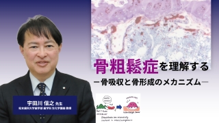 骨粗鬆症を理解する〜骨吸収と骨形成のメカニズム〜の画像です。