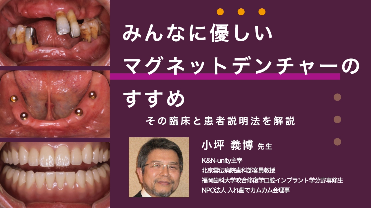 みんなに優しいマグネットデンチャーのすすめ -その臨床と患者