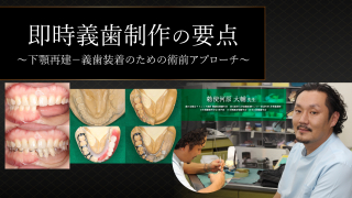 確実に患者満足度が上がる！“リンゴ丸かじりができる”全部床義歯～今井