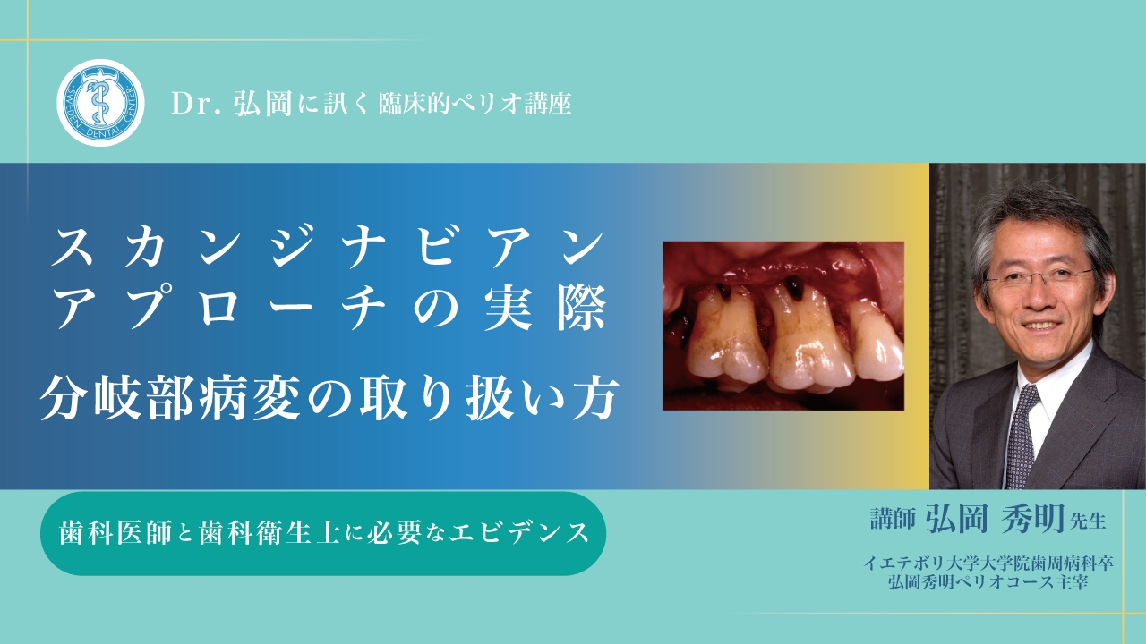 Dr.弘岡に訊く臨床的ペリオ講座 スカンジナビアンアプローチの実際 