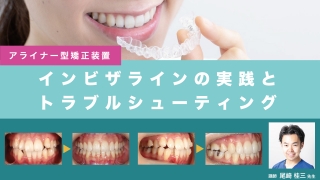 外れることなく超精密かつ最速のアタッチメント設置が実現！年間600