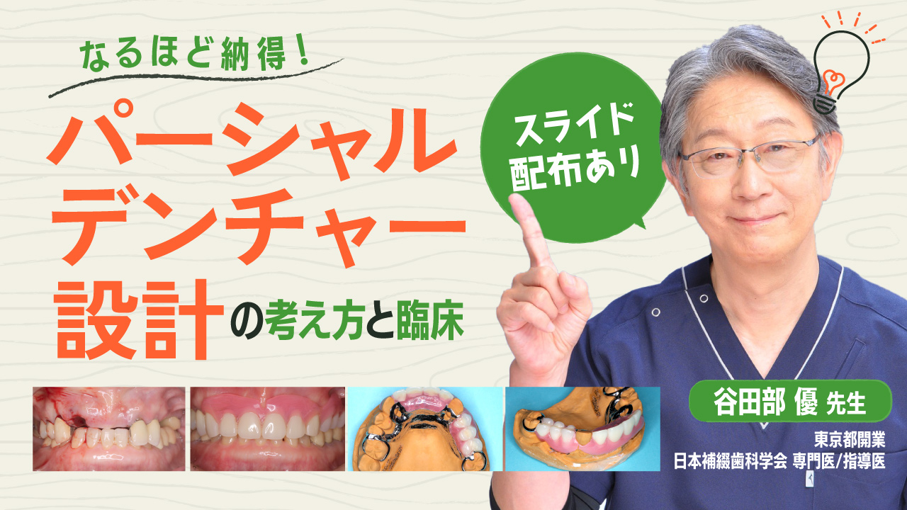 なるほど納得！パーシャルデンチャー設計の考え方と臨床 | WHITE