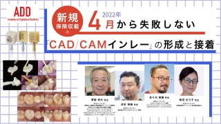 4月から失敗しない！新規保険収載の「CAD/CAMインレー」の形成と接着の画像です。