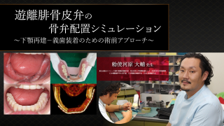 誰にでもできる咬合採得 誰にでもできる咬合採得 | 日本顎咬合学会 |本 | 通販 | Amazon