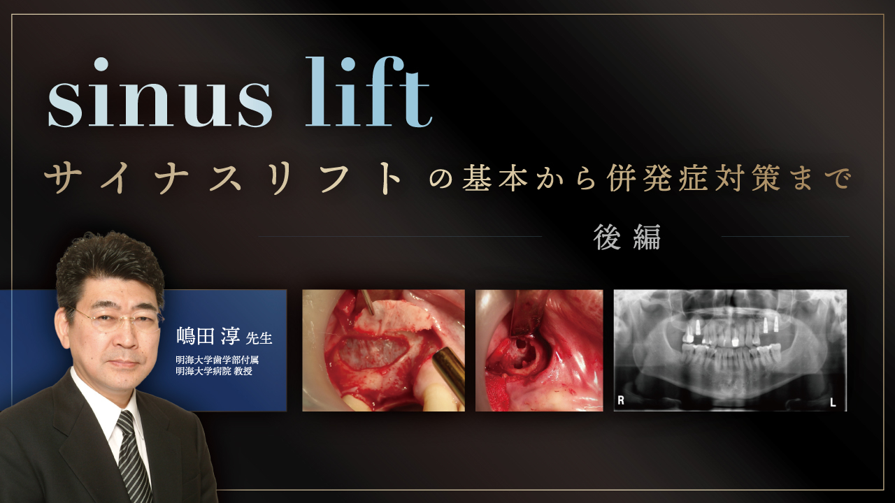サイナスリフトの基本から併発症対策まで〜後編〜の画像です。