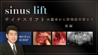 サイナスリフトの基本から併発症対策まで〜後編〜の画像です。