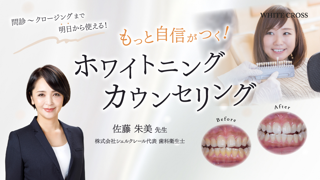 もっと自信がつく！ホワイトニングカウンセリングの画像です。