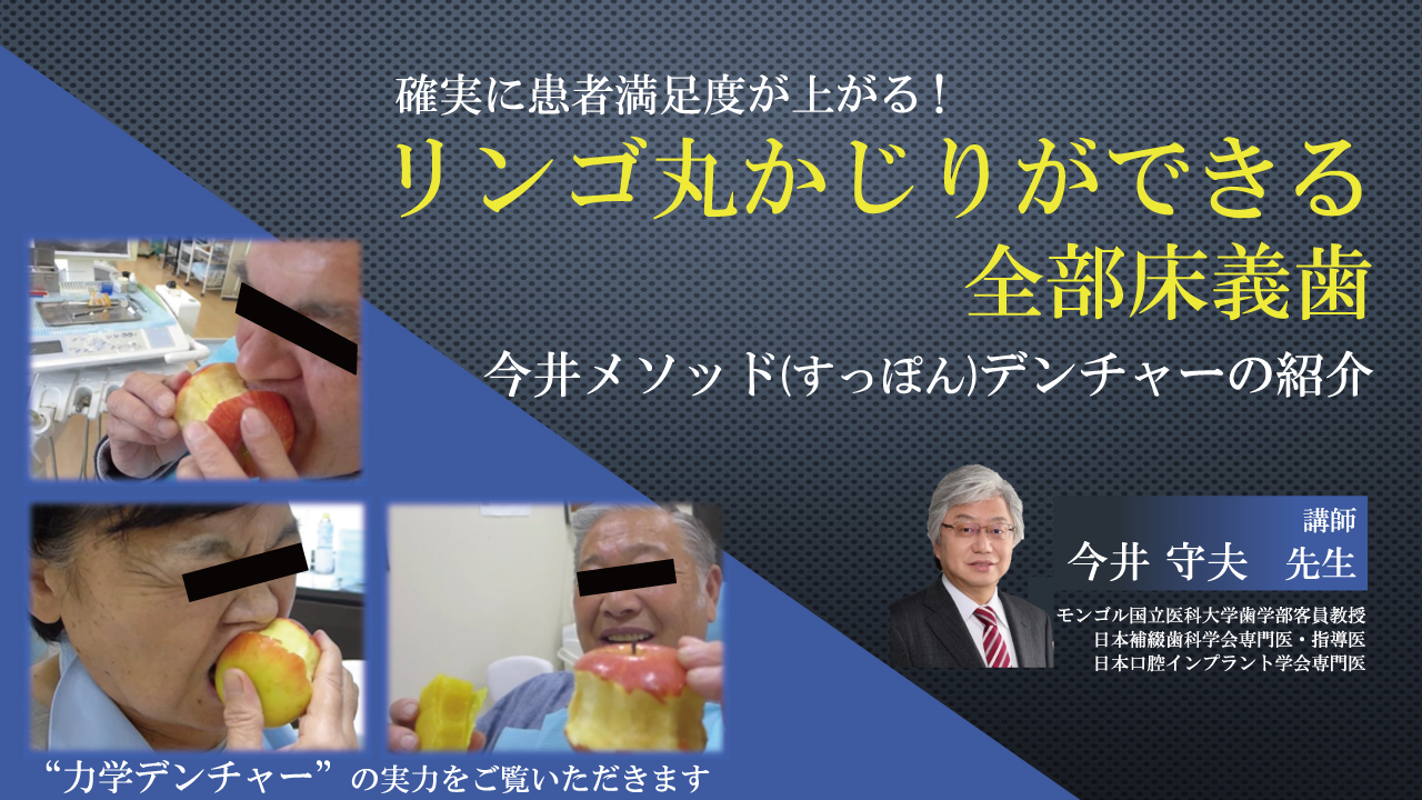 無痛デンチャーの臨床 確実に患者満足度が上がる！“リンゴ丸かじりができる”全部床義歯