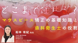 どこまで任せる？マウスピース矯正の基礎知識と歯科衛生士の役割の画像です。