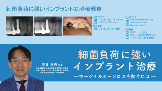 細菌負荷に強いインプラント治療戦略〜マージナルボーンロスを防ぐには〜の画像です。