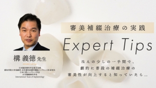 審美補綴治療の実践〜Expert Tips〜の画像です。