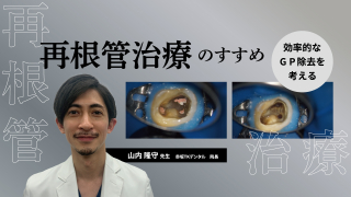 再根管治療のすすめ～効率的なGP除去を考える～の画像です。