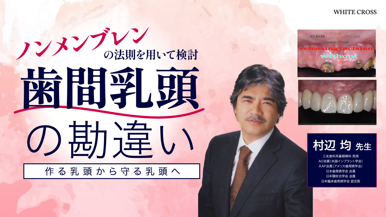 ノンメンブレンの法則を用いて検討 歯間乳頭の勘違い 作る乳頭から守る乳頭への画像です。
