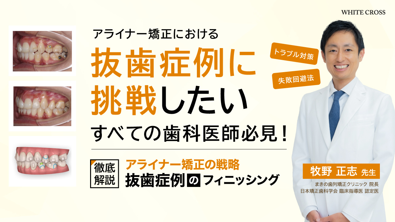 シエン社 | アライナー矯正治療戦略