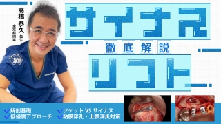 サイナスフロアエレベーション アルティメットガイド 全てを満たす究極
