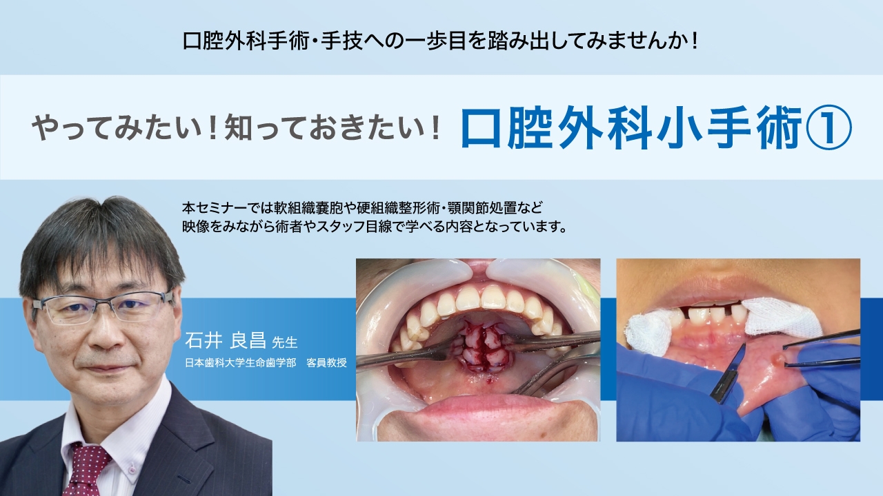 必ず上達歯科小手術 : ここからはじめる!これならできる!テクニック 必ず上達 歯科小手術: ここからはじめる! これならできる