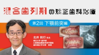 混合歯列期の矯正歯科治療　第2回　下顎前突編の画像です。