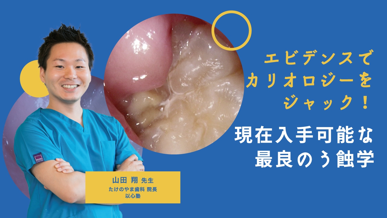 エビデンスでカリオロジーをジャック！現在入手可能な最良のう蝕学の画像です。